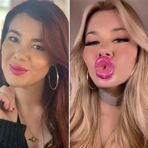 halle hayes|Halle Hayes before and after surgery : r/bimbofication